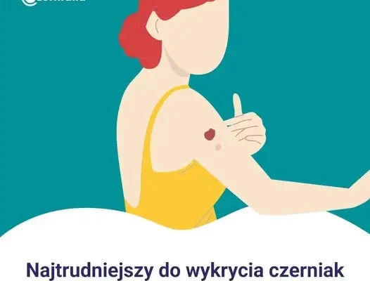 Czerniak bezbarwnikowy – groźny nowotwór, który łatwo przeoczyć jesienią