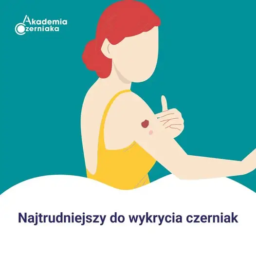 Czerniak bezbarwnikowy – groźny nowotwór, który łatwo przeoczyć jesienią